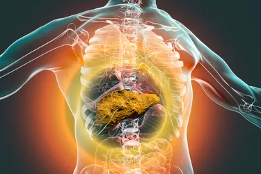 Cirrhosis is scarring of the liver, often caused by fatty liver disease, hepatitis, or alcohol use disorder. (Photo credit: iStock/Getty Images)