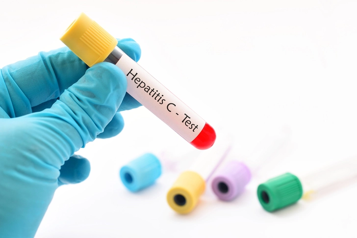 7. There Isn’t a Vaccine For Hep-C 7. There Isn’t a Vaccine For Hep-C