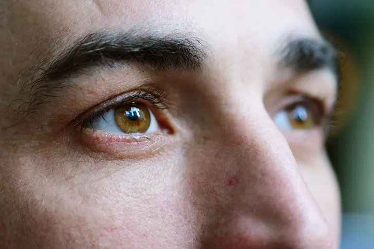 The Eyes, the Immune System, and Lupus