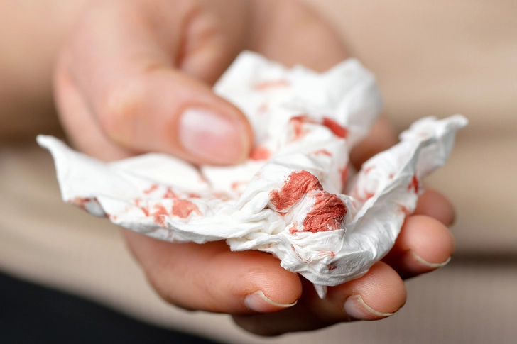 Blood With Coughing Blood With Coughing
