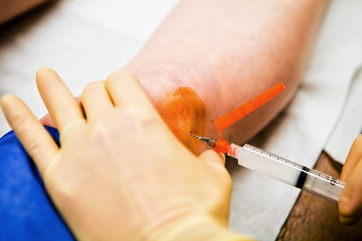 4. Get a Cortisone Injection 4. Get a Cortisone Injection