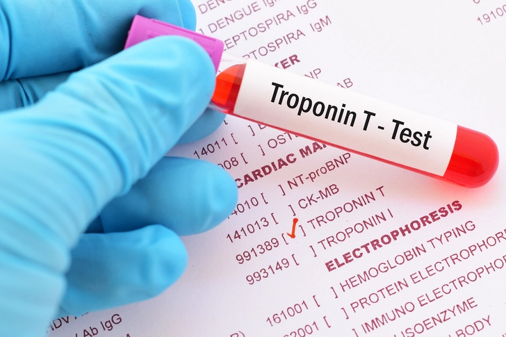 Diagnostic Testing