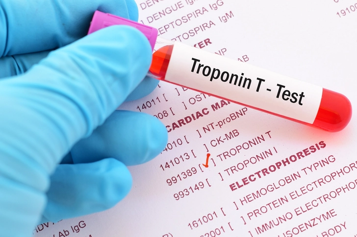 Diagnostic Testing Diagnostic Testing
