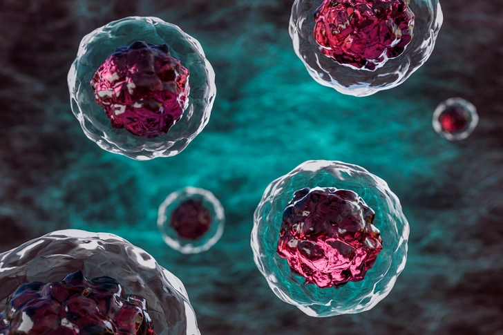 Have You Had a Stem Cell Transplant?