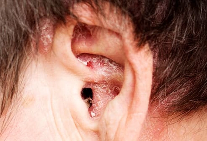Itchy Ears