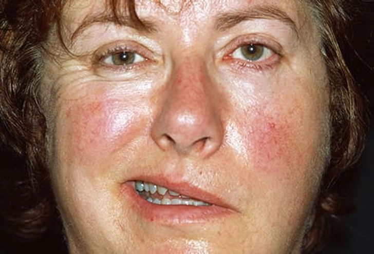 Can’t Move One Side of Your Face Can’t Move One Side of Your Face