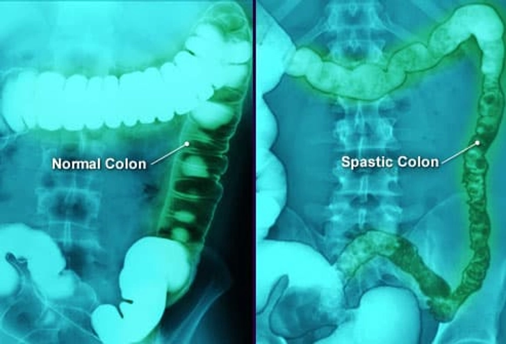 What Are the Causes?