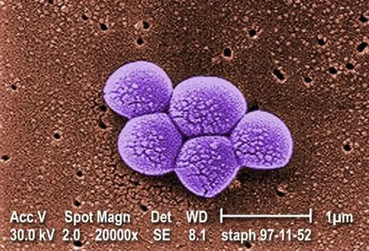 What is MRSA?