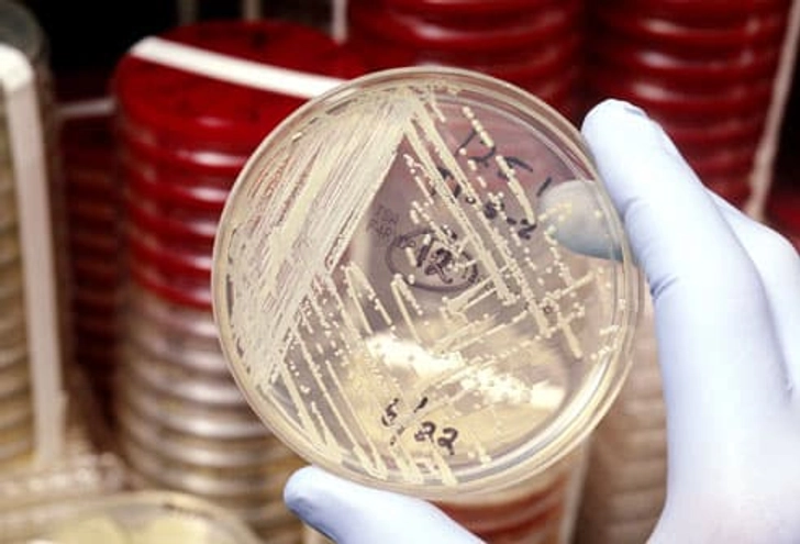 How Is MRSA Diagnosed?