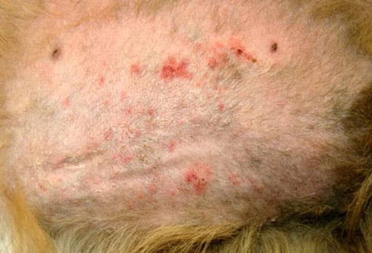 Folliculitis Folliculitis