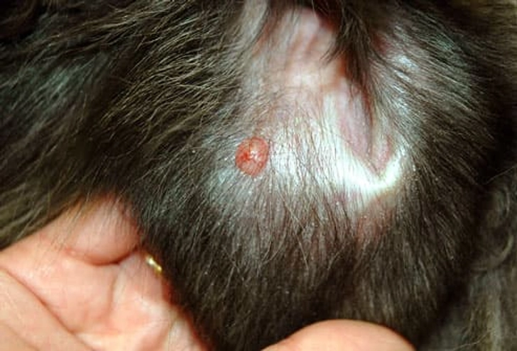 Skin Tumors