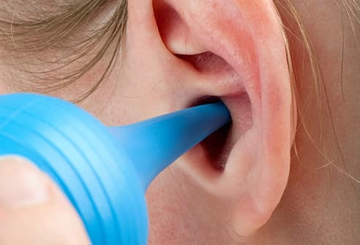 Impacted Earwax