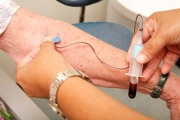 How Is PAD Diagnosed?