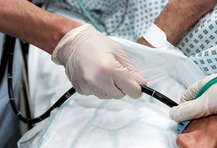 Stomach Polyps: Diagnosis and Treatment