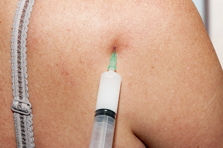 Advanced Treatment Advanced Treatment