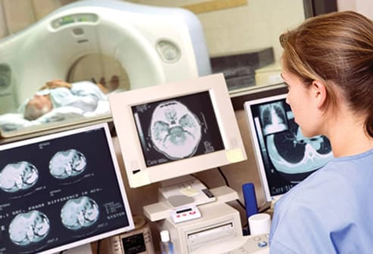 CT Scan CT Scan