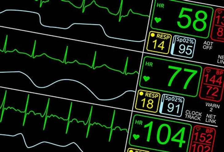 EKG or ECG EKG or ECG