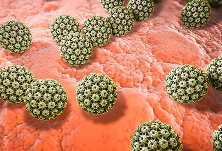 HPV