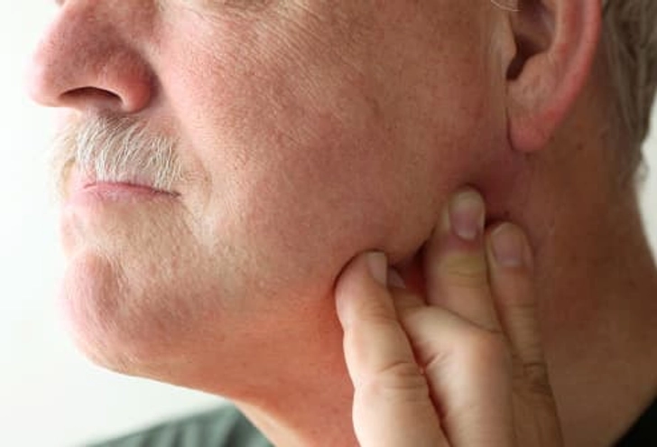 TMJ or TMD TMJ or TMD
