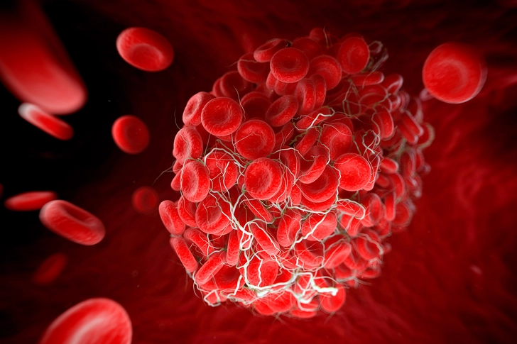 Risks and Complications Risks and Complications