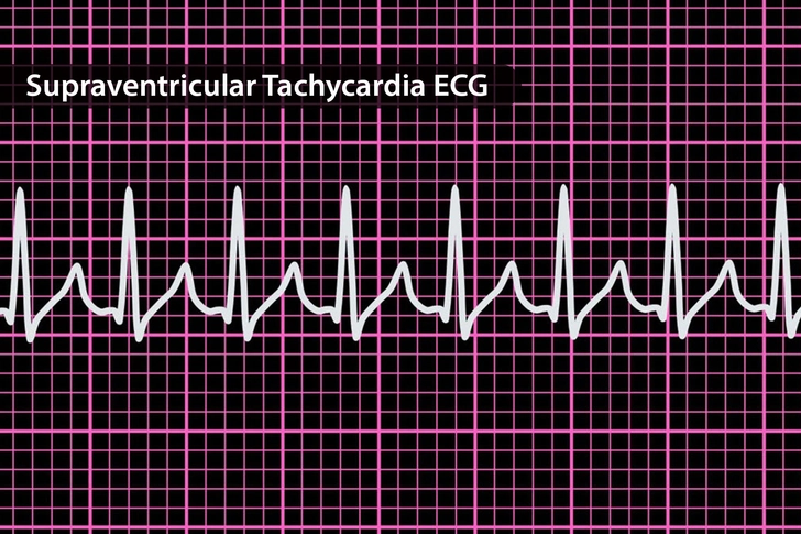 Who Is Ablation For?