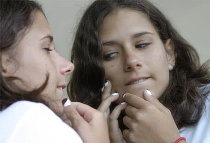 Don't Pop Your Pimples Don't Pop Your Pimples