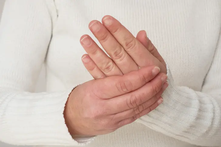 Are Alternate Treatments for Lupus Needed?