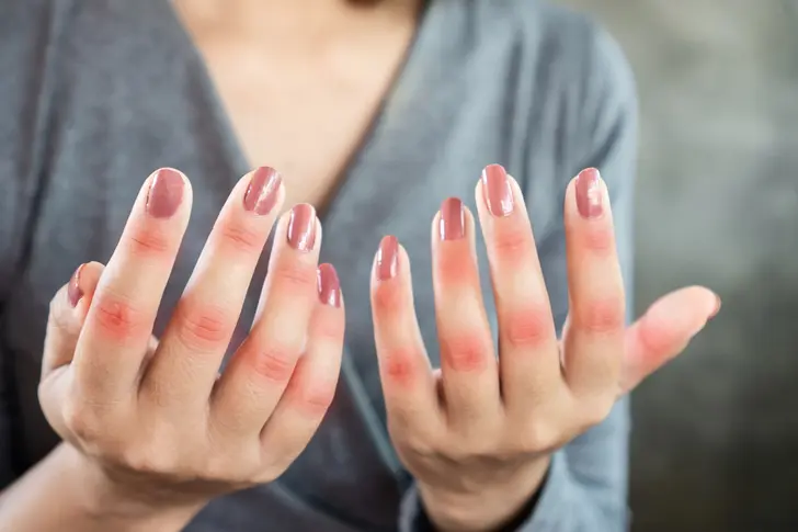 Mental Health Exercises to Manage Stress and Other Lupus Triggers