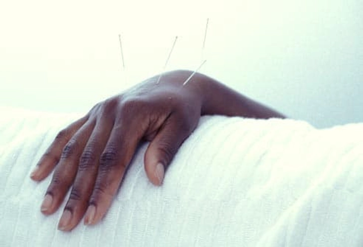 Acupuncture and Cancer Care