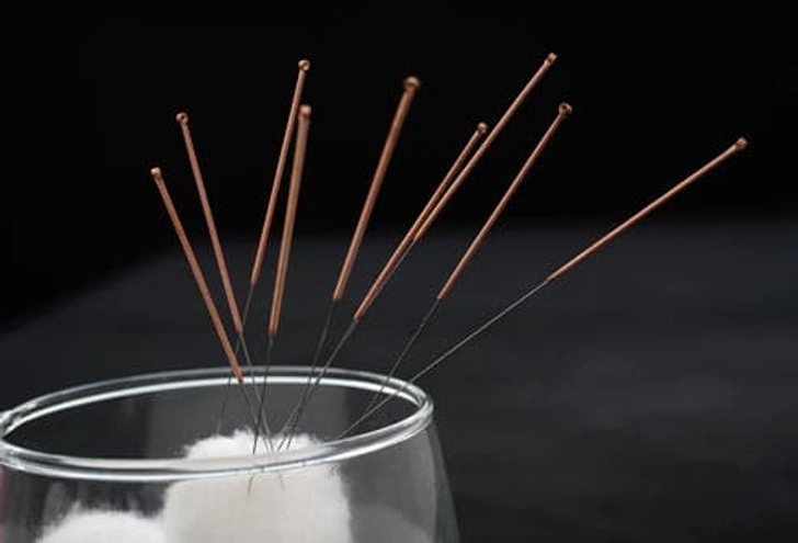 Does Acupuncture Hurt?
