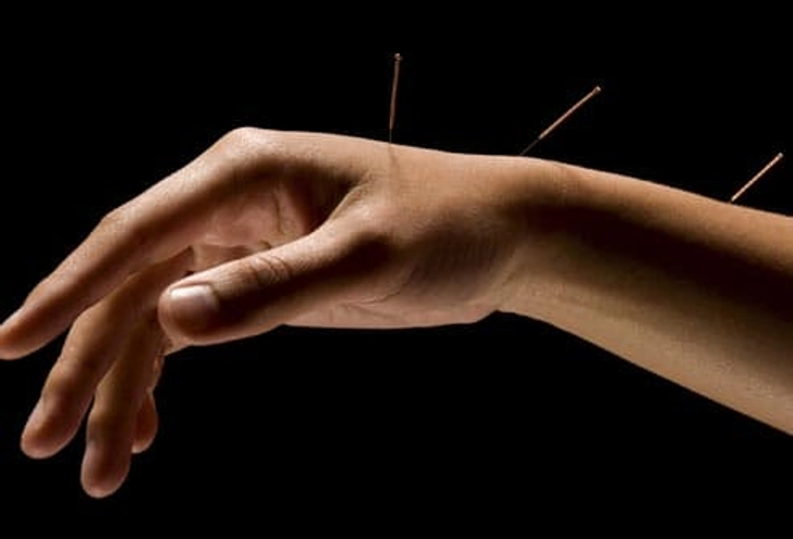 Acupoint: Carpal Tunnel Syndrome