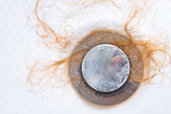 Hair Loss Hair Loss