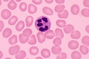Infections Infections