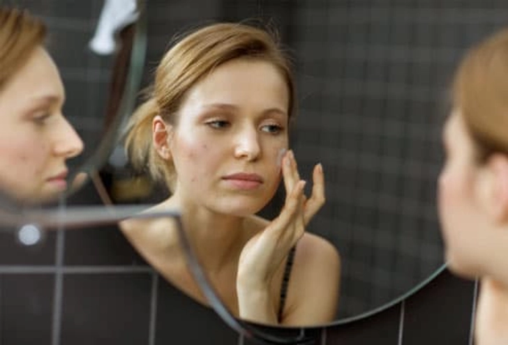 What's the best way to treat acne?