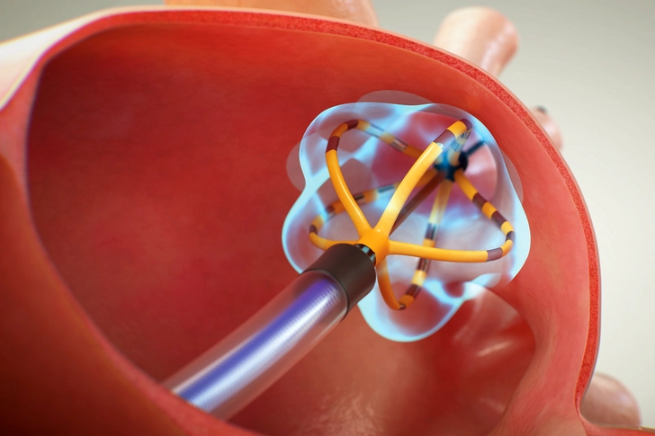Pulsing Ablation