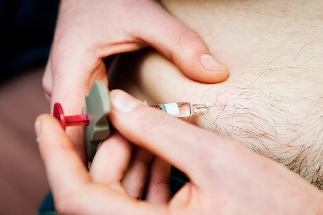New Biologic: Tralokinumab-ldrm