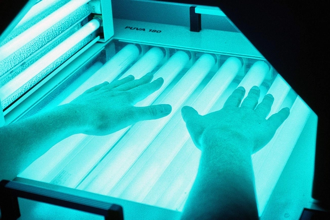 Advances in Light Therapy Advances in Light Therapy
