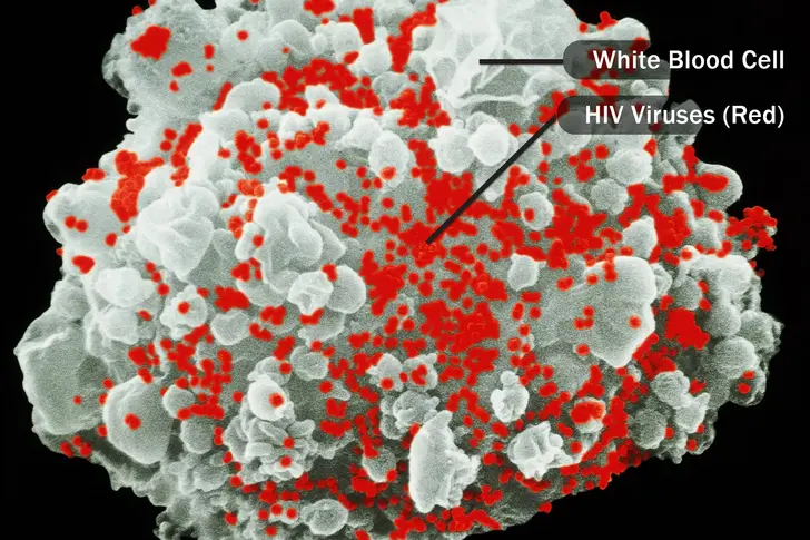 HIV HIV