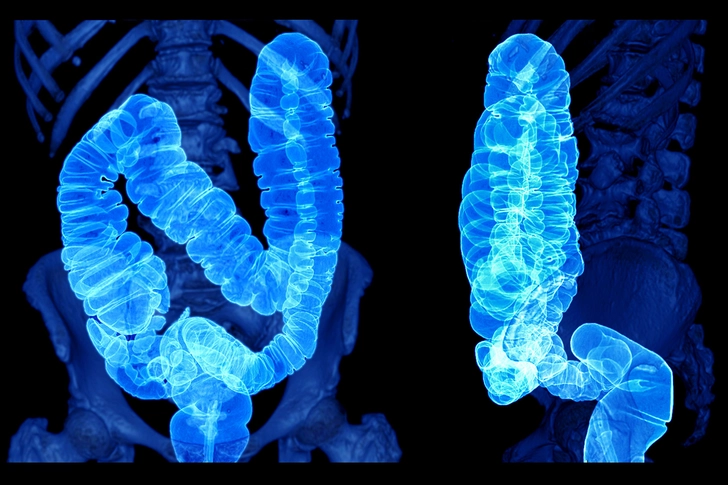 Scoping Out Disease Severity