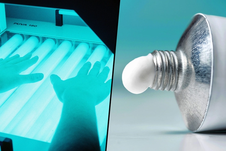 Combining Phototherapy and Topical Treatment