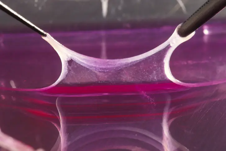 Skin Grafts Skin Grafts