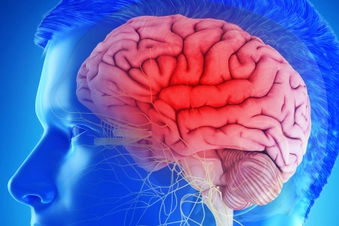 Ibudilast Can Slow Brain Shrinkage