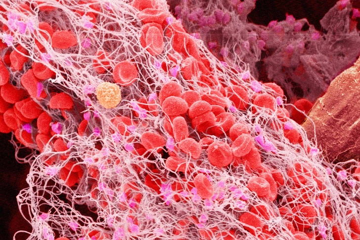 Tranexamic Acid Tranexamic Acid