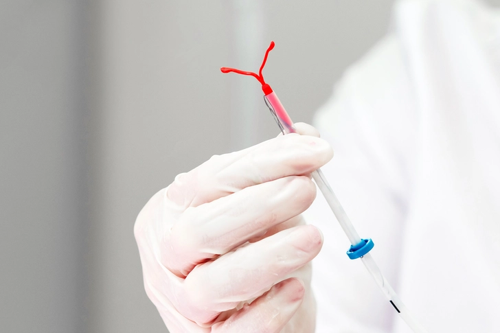 Progestin-Only Intrauterine Device (IUD) Progestin-Only Intrauterine Device (IUD)