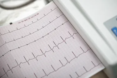 Your doctor may order an electrocardiogram, or EKG, to diagnose a heart murmur. (Photo Credit: sudok1/Getty Images)