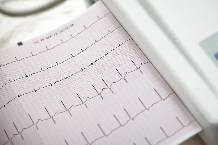 photo of Cardiography