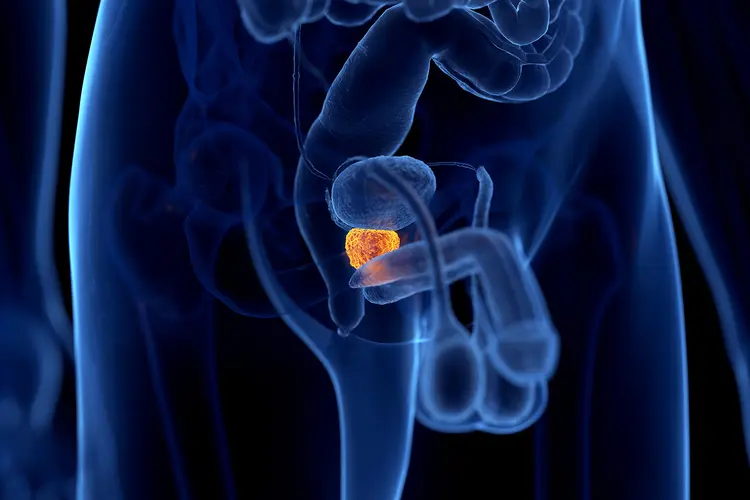 photo of prostate