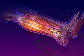 Restless Legs Syndrome Restless Legs Syndrome