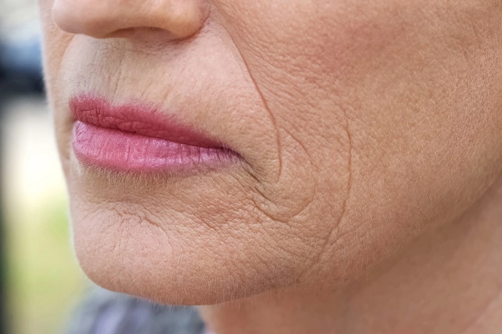 Skin Changes Skin Changes