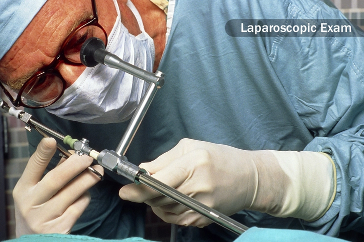 Diagnosis of Bowel Endometriosis Diagnosis of Bowel Endometriosis